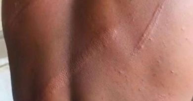 WAES Condemns Assault on Media General Journalist, Warns of Growing Threat to Press Freedom in Ghana